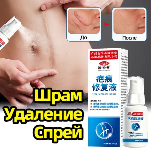 китайский Спрей Гель от шрамов и рубцов / Крем от растяжек, от постакне, для осветления, восстановление, от ожогов, силиконовый гель / 20 мл