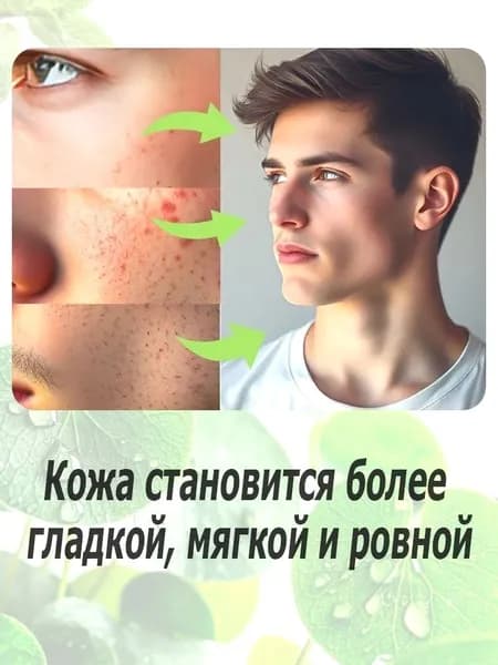 Крем для лица от прыщей и постакне, быстрое заживление, сужение пор и контроль масла, 30 г, для подростков и взрослых