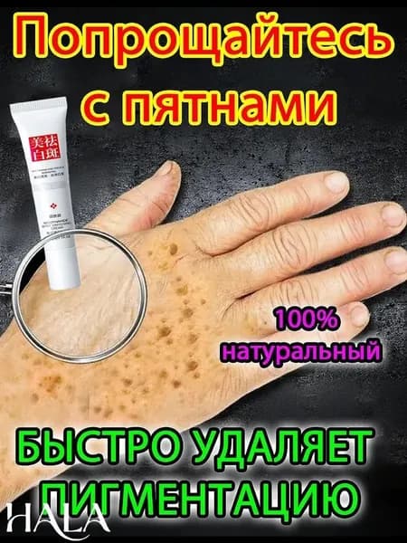 Отбеливающий крем от веснушек и солнечных пятен, подходит для удаления и исчезновения желтых пятен и старческих пятен, 20 г.