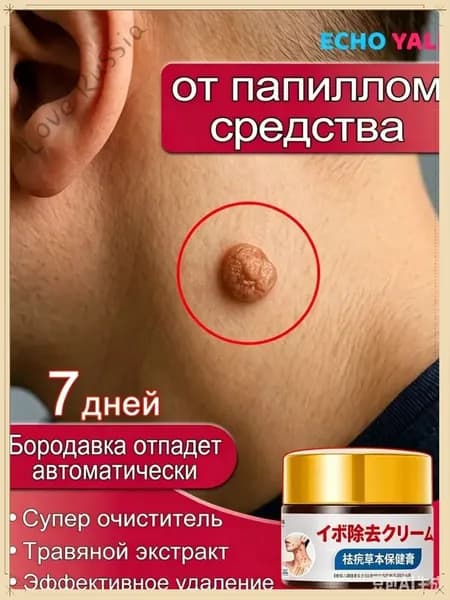 ECHO YALI / Мазь для удаления бородавок, папиллом и новообразований, быстрая и безболезненная, без каких-либо побо