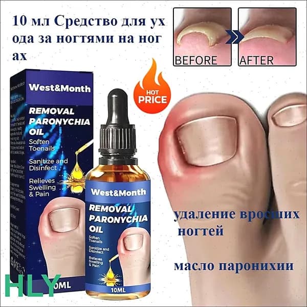 20 г лака для вросших ногтей, устраняет паронихию, укрепляет ногти