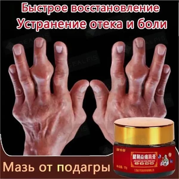 1 шт. Крем для лечения подагры, 30г артрита, боли в пальцах и суставах,мышцах, при артрите