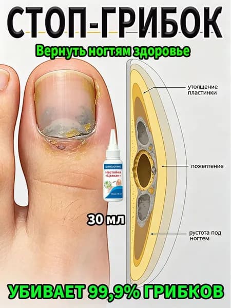 Мощное противогрибковое масло от грибка ногтей. Помогает при онихомикозе, утолщении и пожелтении. Без боли и запаха.