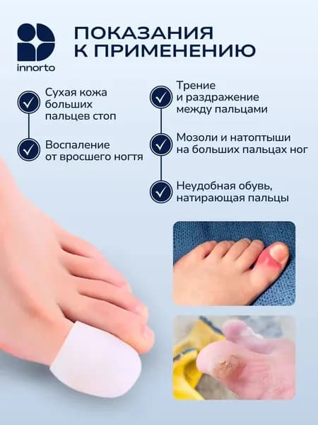Напальчник. Колпачки для защиты стопы от натоптышей и мозолей на ногах. Корректор пальцев