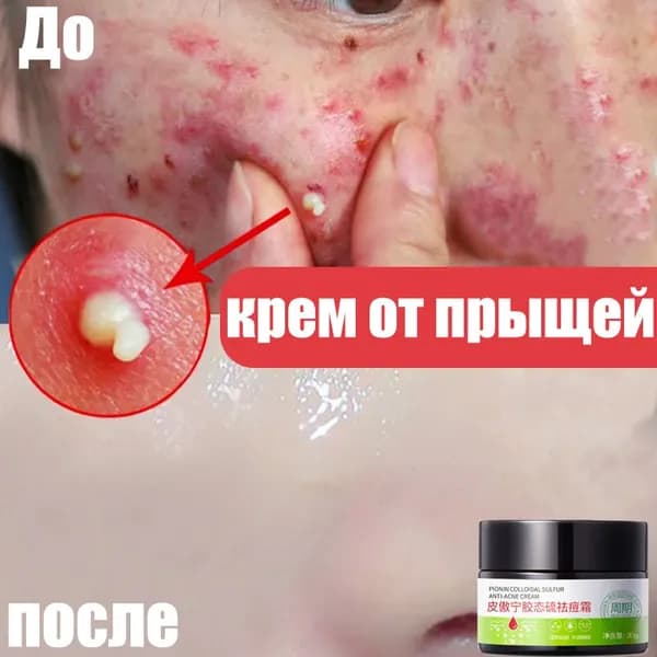 Крем для ухода за кожей