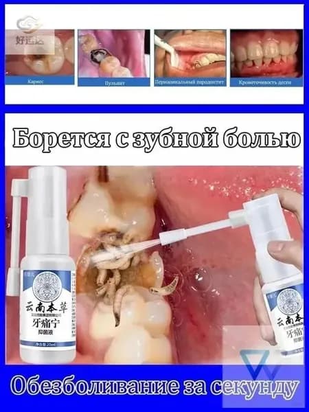 Спрей для лечения зубной боли, при зубной боли, воспалении десен, язвах во рту, снимает боль и отек, 20 мл