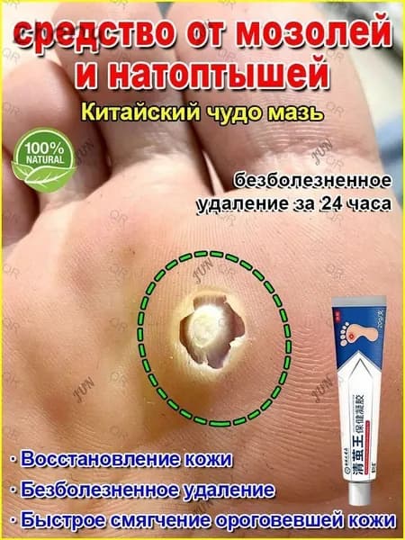 Средство для удаления натоптышей