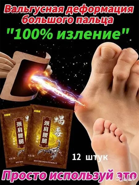 пластырь от косточки на большом пальце Облегчите боль в ногах и улучшите выпячивание суставов