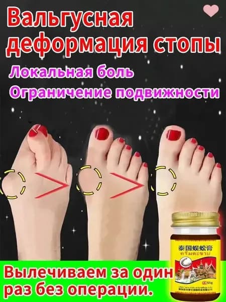 Легендарный тайский крем от косточки на ноге