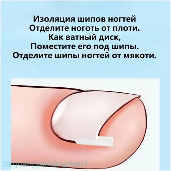 Качественный корректор для вросших ногтей