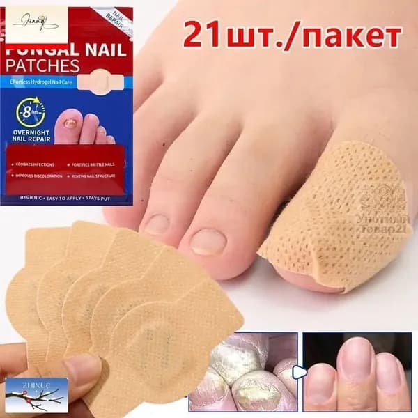 Мягкие пластыри от грибка ногтей