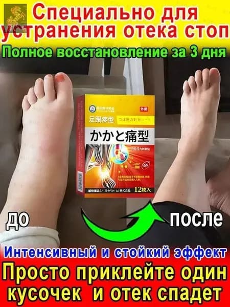 Пластырь от боли в пятках средство китайские лекарства для суставов для снятия дискомфорта ступней и суставов