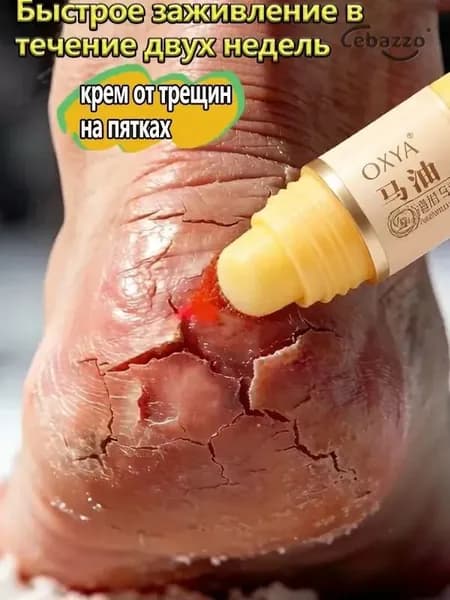 Крем воск от трещин для очень сухой кожи, крем для ног с мочевиной 5%, от трещин на пятках, воск для пяток