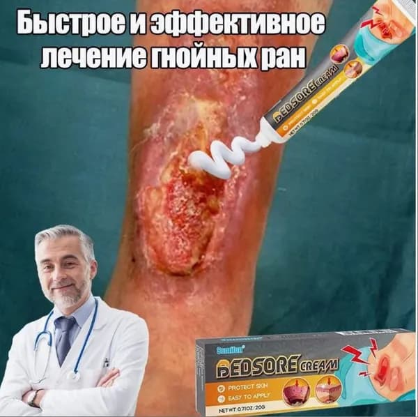 Мазь для ран для остановки кровотечения, уменьшения воспаления и отека. Язвы и ожоги кожи, диабетическая стопа