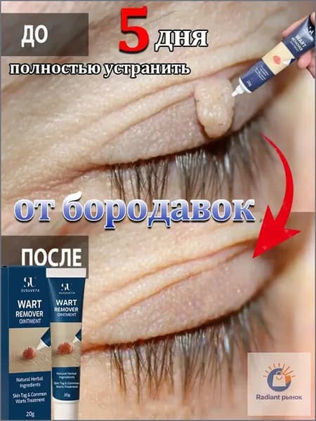 SUSUVETA Мазь от папиллом и бородавок. Подходит для различных типов бородавок. Снижает проявления за 5 дня. Бережный уход с чистотелом. Без боли и следов. Объем 20 г.