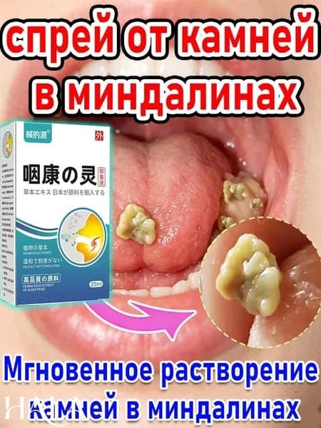 Набор для гигиены миндалин: удаление камней и спрей для свежести дыхания