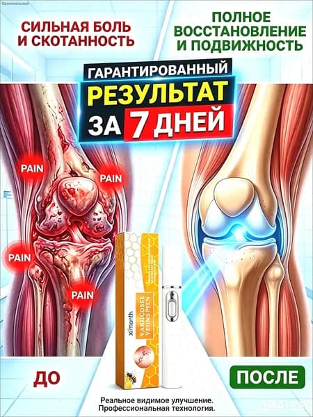 Обезболивающий лазерная указка при артрите,для снятия боли при подагре, артрите, опухших суставах, болях в спине, уменьшает отек и снимает боль,1 ШТ