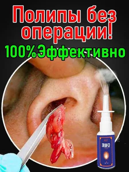 Спрей от полипов в носу без операции, 20 мл