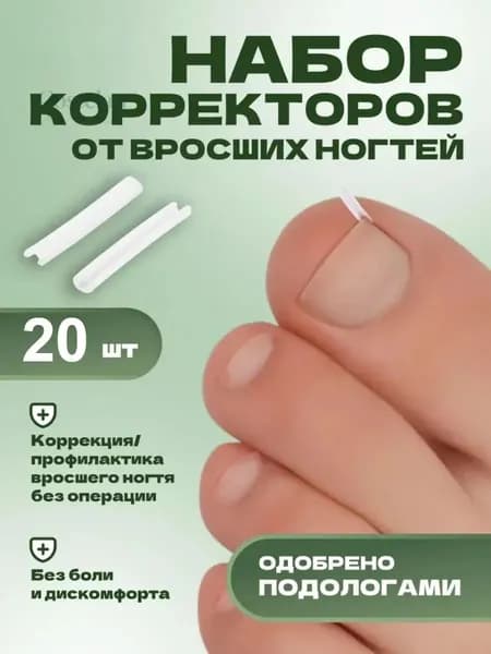 Корректор От Вросших Ногтей На Ногах