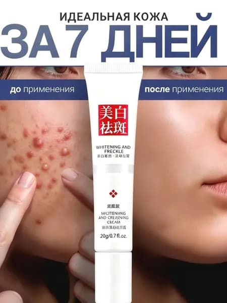 VOIS Крем для лица от воспалений с ниацинамидом,Точечный крем от прыщей,гель для лица от прыщей и черных точек точечный, корректирующий с ниацинамидом и цинком для проблемной кожи,20 г