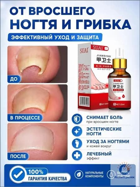 Масло премиумкласса для ногтей и кутикулы, 10 мл, применяемое при врастании, с интенсивным уходом за загрубевшей кожей стоп.