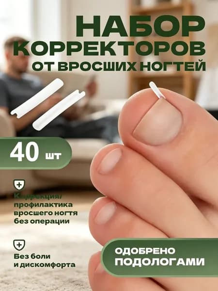 Корректор От Вросших Ногтей На Ногах