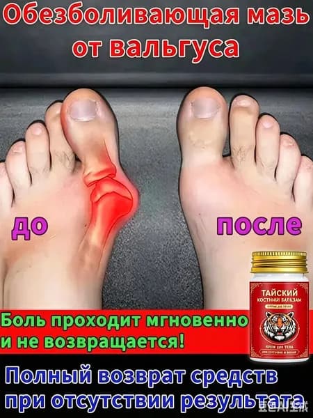 Китайская чудо мазь от вальгуса и косточки на ноге 55 г