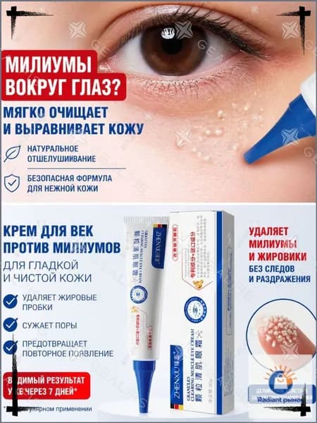 Эксклюзивная мазь от жировых гранул на веках, быстрое удаление милиумов под глазами, крем для качественного ухода
