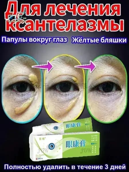 Мазь от ксантелазмы и ксантом на веках и лице. Лечение папул и желтых бляшек вокруг глаз. Эффективное средств