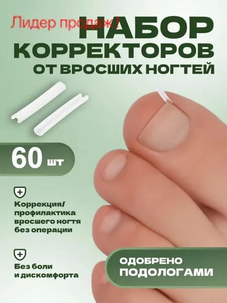 Корректор От Вросших Ногтей На Ногах