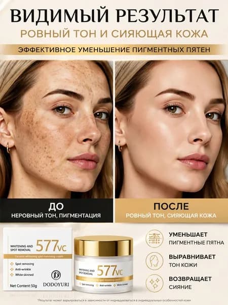 577 Крем для осветления кожи и удаления пигментных пятен эффективно удаляет старческие пятна, веснушки и пигментные пятна, борется с гиперпигментацией и улучшает цвет лица, 50 г