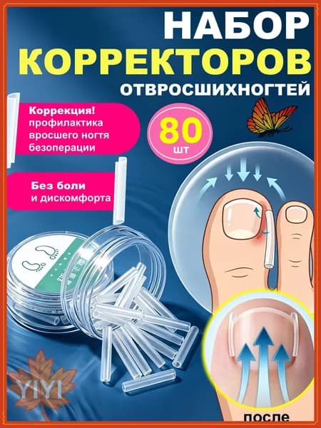 80 шт, Корректор от вросшего ногтя, вставка для ногтей на ноге