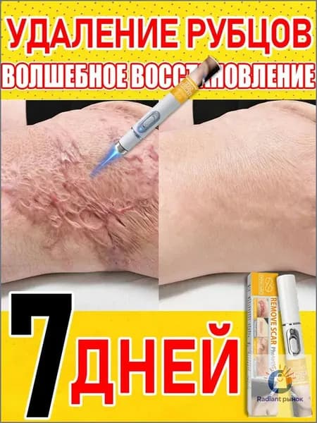 Лазерная ручка для удаления шрамов, удаляет шрамы, родинки, ожоги, растяжки, следы ожирения, лечит послеоперационные шрамы, предотвращает образование рубцов, восстанавливает кожу.1 упаковка