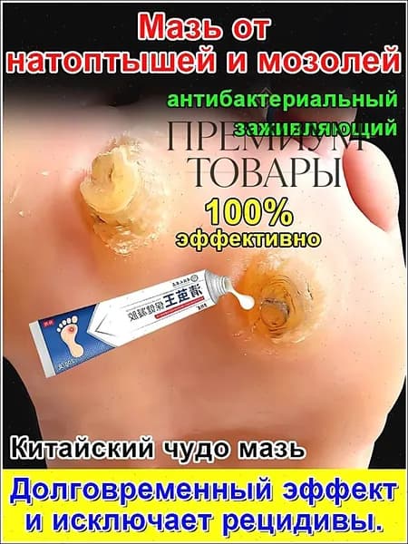 Mазь от мозолей стержневых и натоптышей ,Крем от сухих мозолей, шипицы, бородавок, натоптышей,20 г