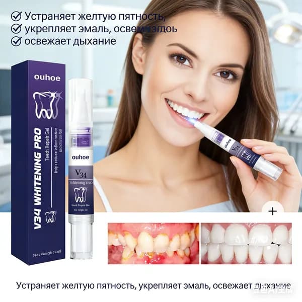 Отбеливающий карандаш для зубов: быстрый результат без повреждения эмали