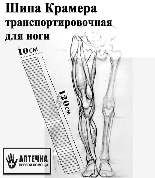 Шина Опора иммобилизационная лестничная транспортировочная Крамера для ноги . Шины транспортные проволочные для иммобилизации переломов нижних конечностей