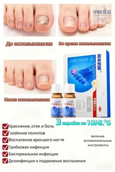 Гиалуроновая сыворотка: восстановление и уход при панариции