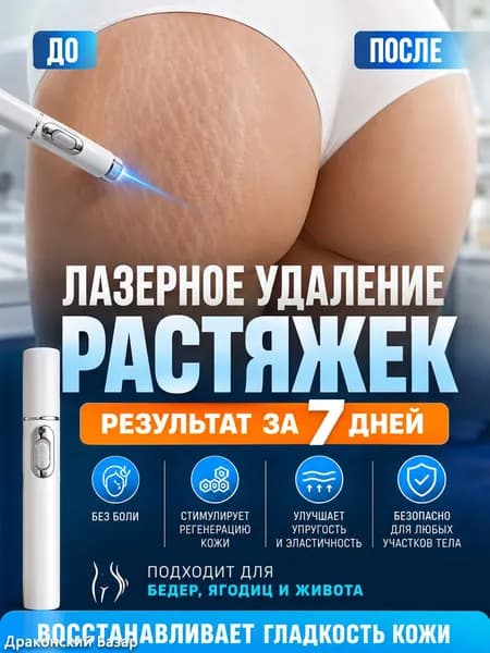Портативная лазерная ручка для удаления растяжек и стрий, для лица и тела, без боли, для домашнего использования