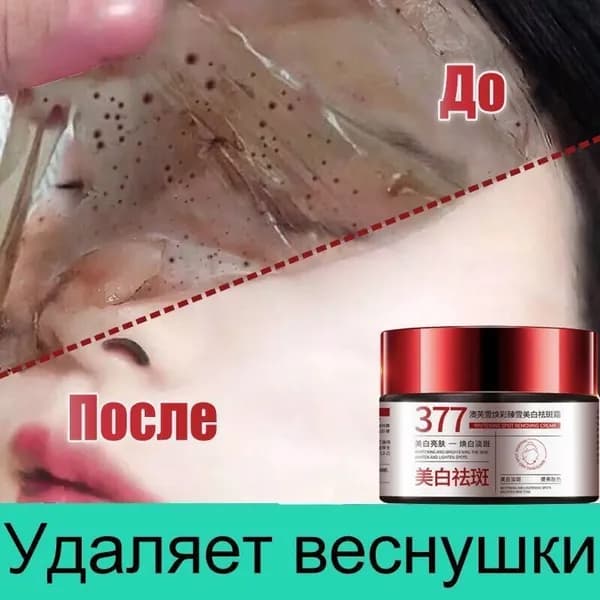 Крем для лица от Веснушек и Пигментных пятен 30г против пигментации, отбеливающий для лица увлажняющий, Содер