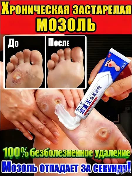 средство для удаления натоптышей и мозолей.Быстрый эффект/20 г