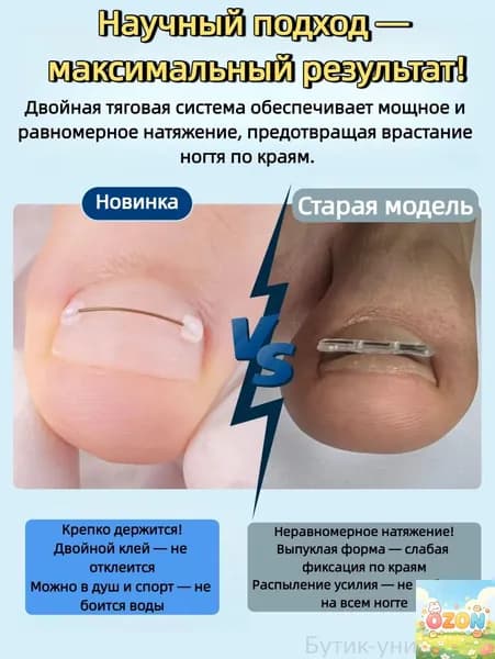 Набор для коррекции вросшего ногтя из никель-титанового сплав