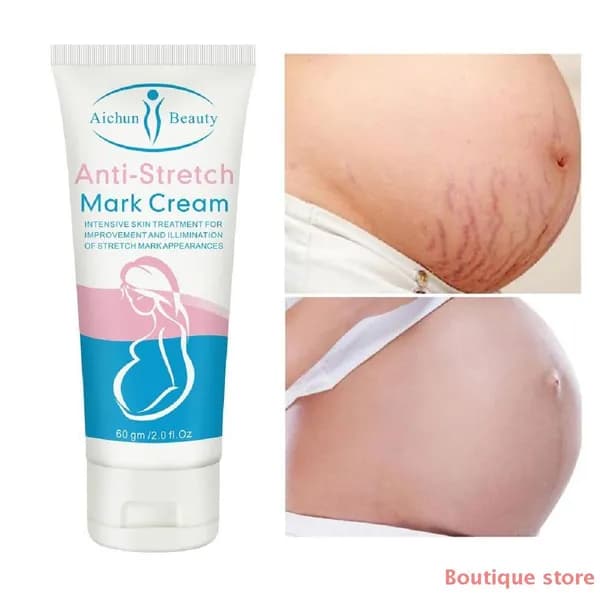 Anti-Stretch Mark Cream укрепляющий , крем укрепляющий от растяжек для беременных, 60 г 88