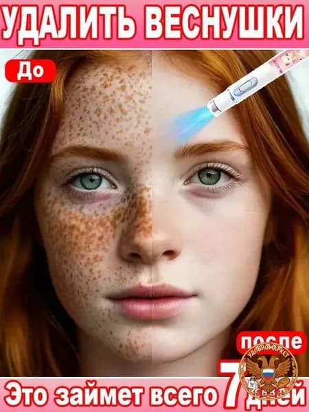 Лазерное удаление веснушек быстро и эффективно удаляет веснушки, пигментные пятна, мелазму и другие виды пигментации; осветляет и выравнивает тон кожи. 1 шт.