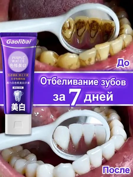 фиолетовая зубная паста отбеливающая ,отбеливание зубов ,пожелтевшие зубы, удаление чайного и кофейного налета, и эффективная защита от кариеса,Уход за полостью рта100 г