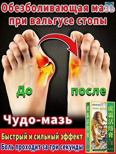 мазь от косточки на большом пальце, от шишек на больших пальцах ног