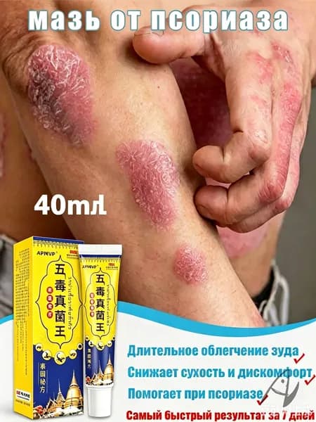 Негормональная мазь от псориаза, дерматита, экземы, нейродермита и грибковых заболеваний, 20 г
