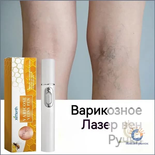Ручка для лечения варикозного расширения вен,использовать для лечение сосудистых звездочек, тромбоза,отеков и тяжести в ногах,улучшает кровообращение