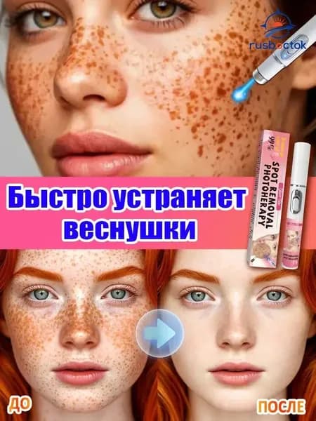 Лазерная ручка от веснушек эффективно удаляет веснушки, пигментные пятна и макулярные пятна, отбеливает кожу, восстанавливает ее и придает коже сияние.1 штука