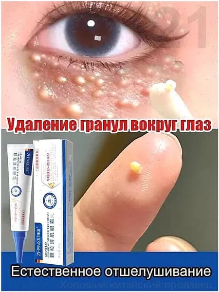 Премиальный крем для зоны век от ксантелазм, выравнивающий текстуру и убирающий несовершенства, 30 г