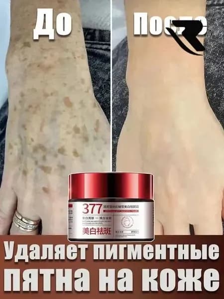 Крем от пигментации для лица, удаляет пигментные пятна, против пигментации, осветляет, для мужчин и женщин, 30 г